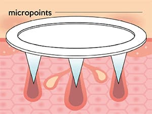 Problemfri MICRO-POINT PATCH PLUS BEGRÆNSET VÆRDIPAKKE 18 stk.