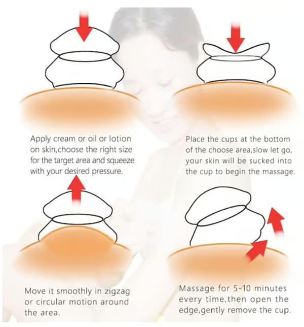 Cupping sæt til helkropsmassage – 4-pak (L–XS)
