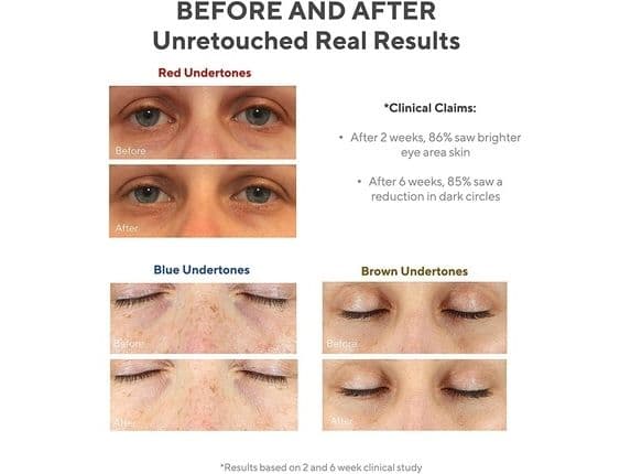 Murad Eyes Vita-C Dark Circle Corrector 15ml