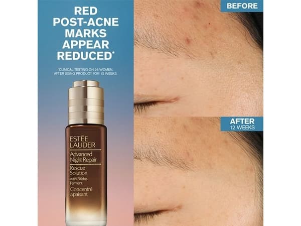 Estee Lauder Advanced Night Repair Rescue Solution 20 ml