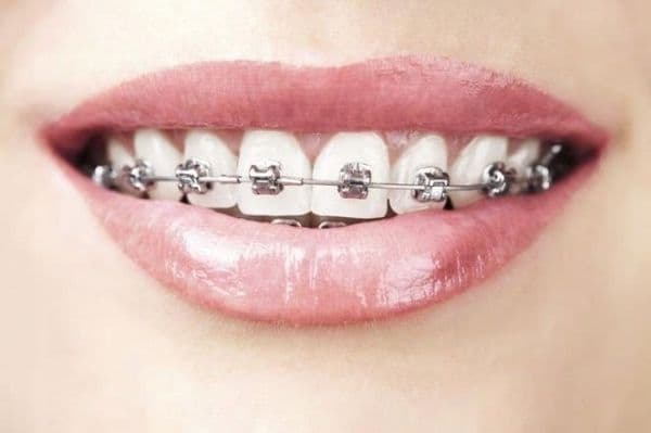 Acts PASTE SALVIA ORTHO DENTAL DAY 75 ML