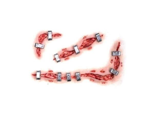 Staplestein FX