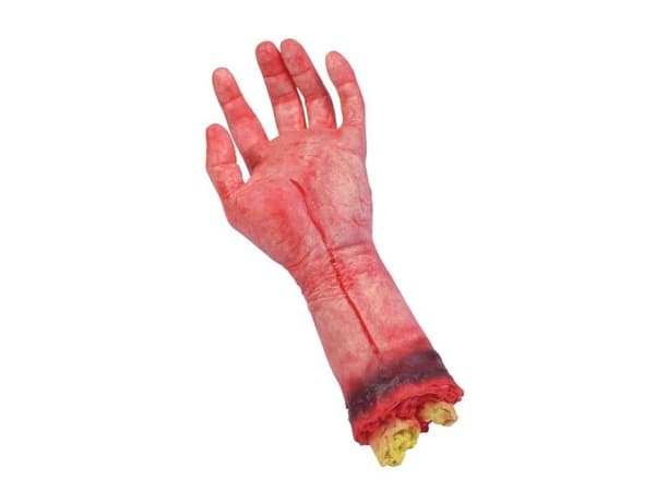 Avhuggen hand