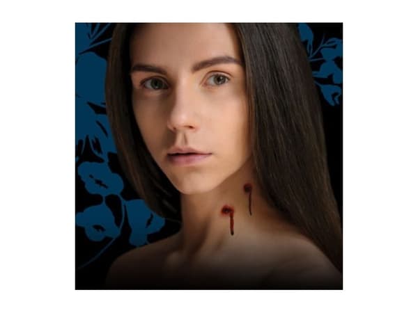 Vampyrbett sår