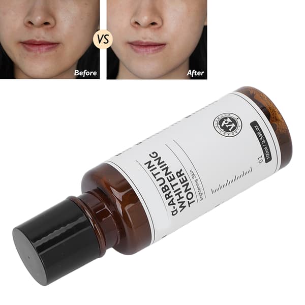 Arbutiini-valkaiseva kasvovesi C-vitamiini syväkosteuttava kirkastava ihovesi 100ml