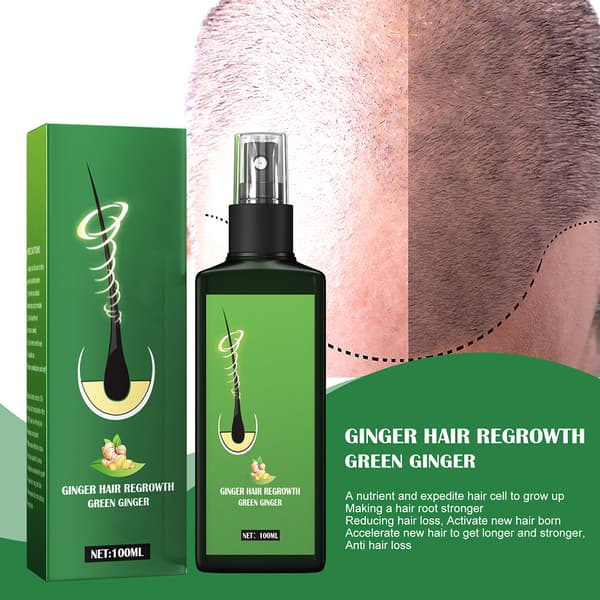 Ingefära Hårväxtserum Spray Hårväxtvätska Förhindra Håravfall Återväxt Närande Ingefäraspray