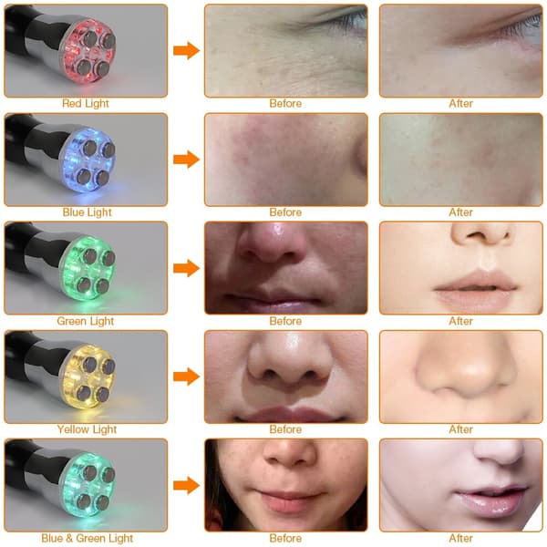 Bärbar ansiktsföryngringsmassager Anti-Aging Skönhetssalongutrustning