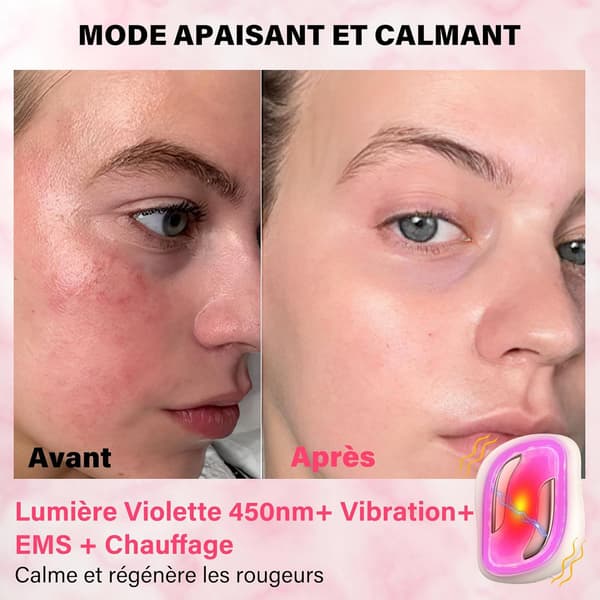 Elektroterapi ansigtsmassage, vibration/varme, 4 EMS-tilstande, 4-farvet enhed
