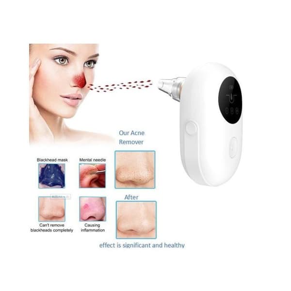 Blackhead extractor med sugeeffekt - 6 i 1