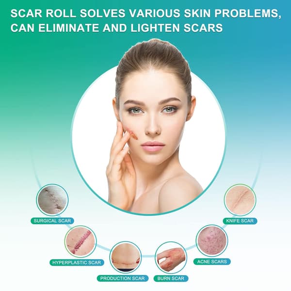 Arpiteippi - Silikoniarpiarkit Beige 3 m