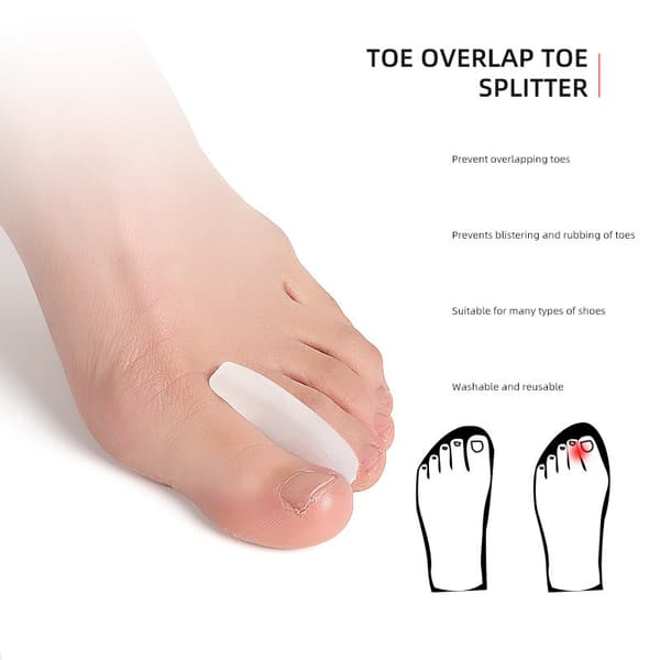 Tåudretter, Tåseparator S
