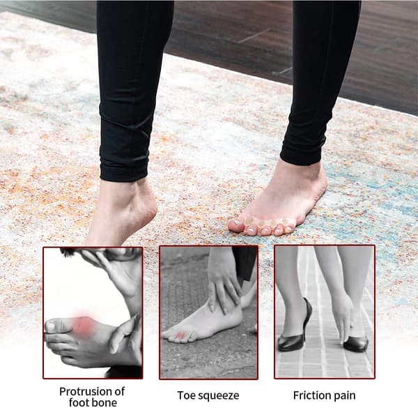 Tåskiller til Hallux valgus 1 par Beige