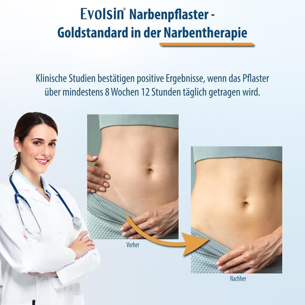 Arrtape - Silikonarrark Matte transparent color 3m