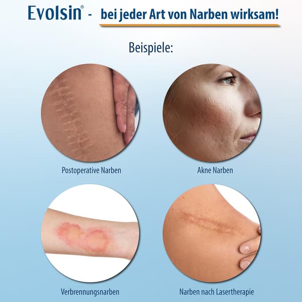 Ärrtejp - Silikonärrark Matte transparent color 3m