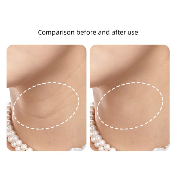 Halsrynkeplaster - Reduser fine linjer (5 plaster)
