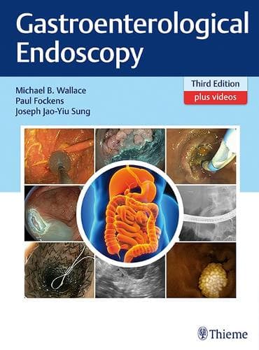 Gastroenterologisk endoskopi