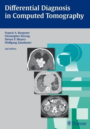 Differentialdiagnose i computertomografi