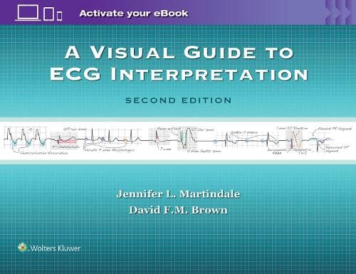 En Visuel Guide til EKG-Tolkning