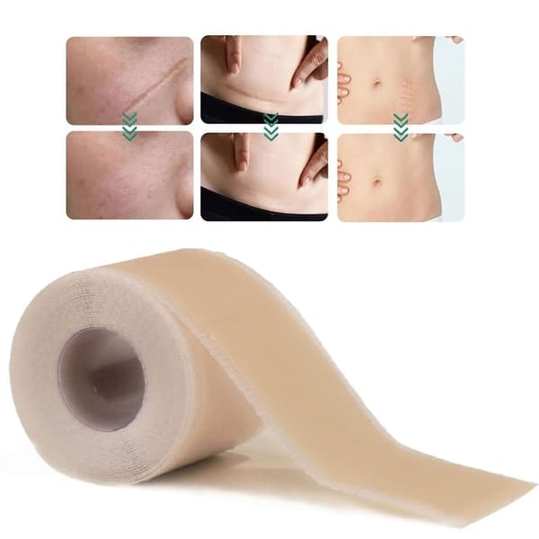 Silikontejp / Plåster för Ärr - Behandla ärr - 5-Pack