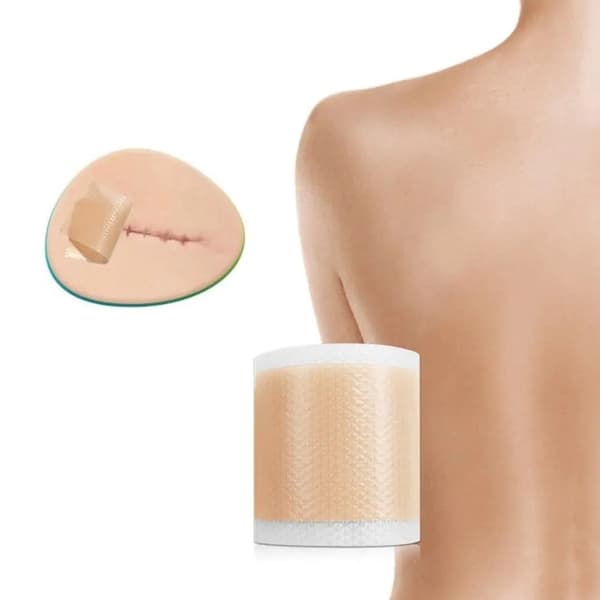 Silikonetape / Plaster til Ar – Behandling af ar - 5-Pack