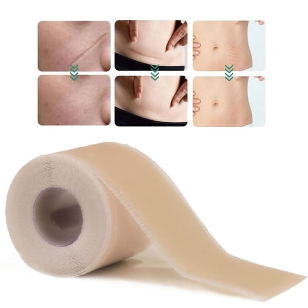 Silikontape / Plaster for Arr – Behandling av arr - 3-Pack