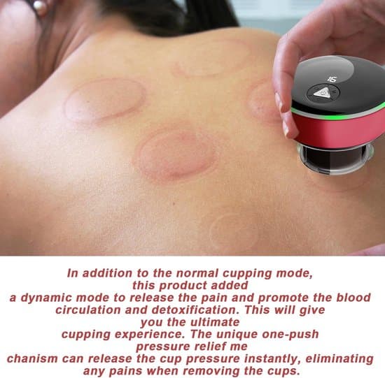 Cellulitmassageapparat - Anti-cellulitapparat - Koppningskoppar - Hudvårdsset