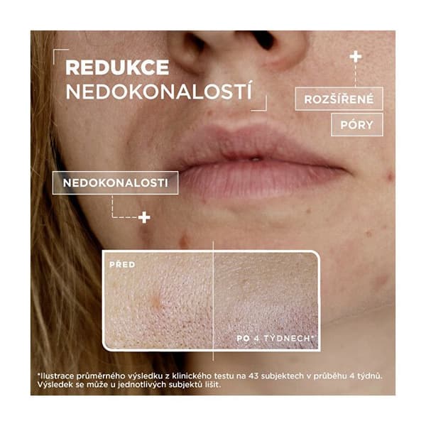 Sérum anti-imperfektion (Serum) 30 ml