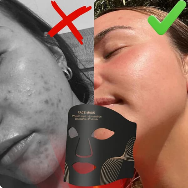 7-färgad LED-ansiktsmask - ljusterapi