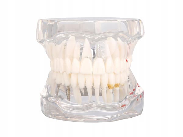 Dentalmodell 2 Vit (100) GAB_B