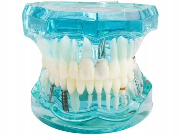 Dentalmodelli 2 sininen (100) GAB_B