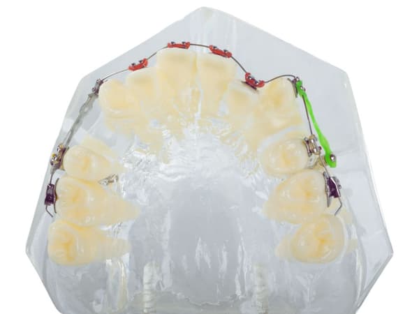 Modell Dental Apparat (100) / 60