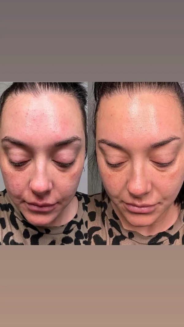 Farmasi - Absolute Super Elixir gavesæt 2x tør olie + roller
