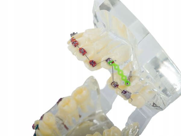 Modell Dental Apparat (100) / 60