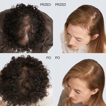 L'Oréal Elseve Vækstbooster Anti-Hårtab Shampoo 200ml