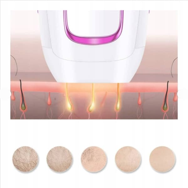 IPL hårfjerning med laser - 5 intensitetsniveauer