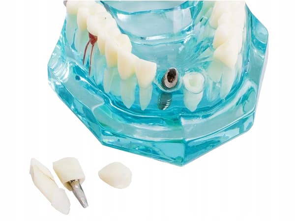 Dentalmodelli 2 sininen (100) GAB_B