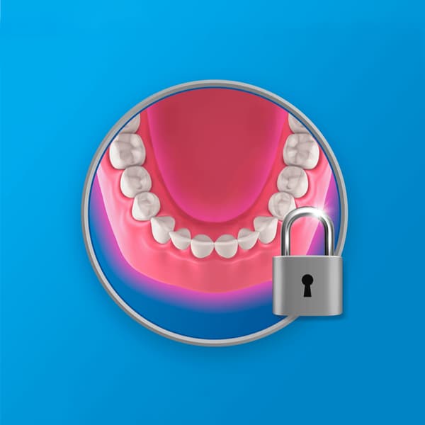 Tandproteshäftämne Fixodent 21 G