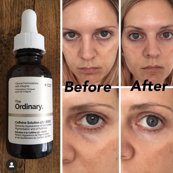 The Ordinary Sérum Caffeine Solution Essence 5 % + EGCG silmänhoitoon