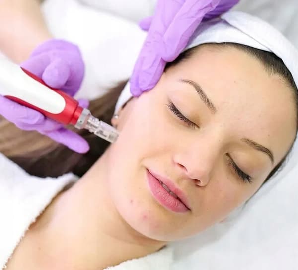 DERMA PEN Mikronåle Mesoterapi Sæt + 2 Dermapen Patroner