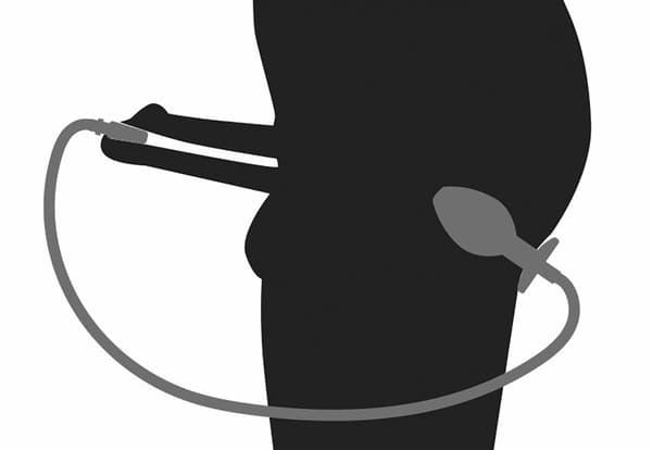 Penisplugg Analplugg med Urinrörsstimuleringsplugg