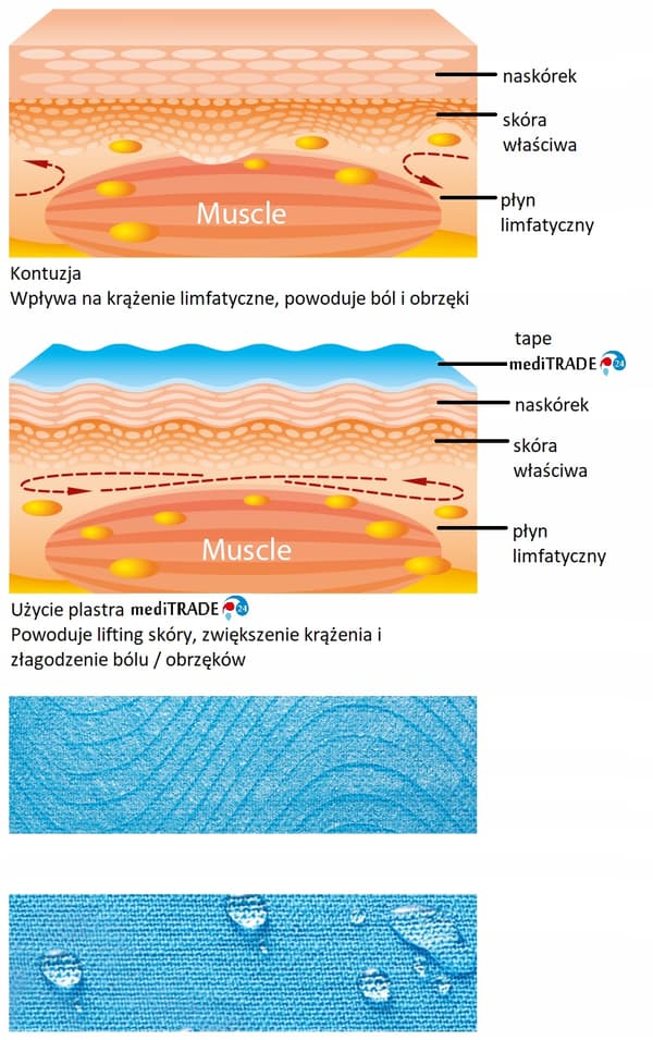 KINESIOTEIPPAUS KINESIOTEIPPI 5M