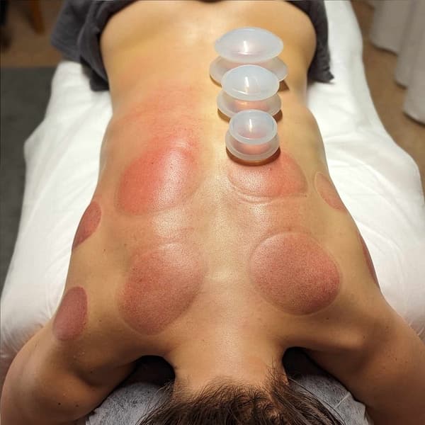 Cupping sæt – Effektiv og afslappende cupping massage