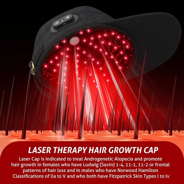 Hårväxtapparat, Låg nivå laserterapi, Bärbar design,1 set
